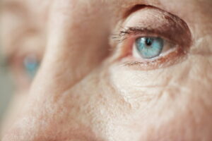 Glaucoma